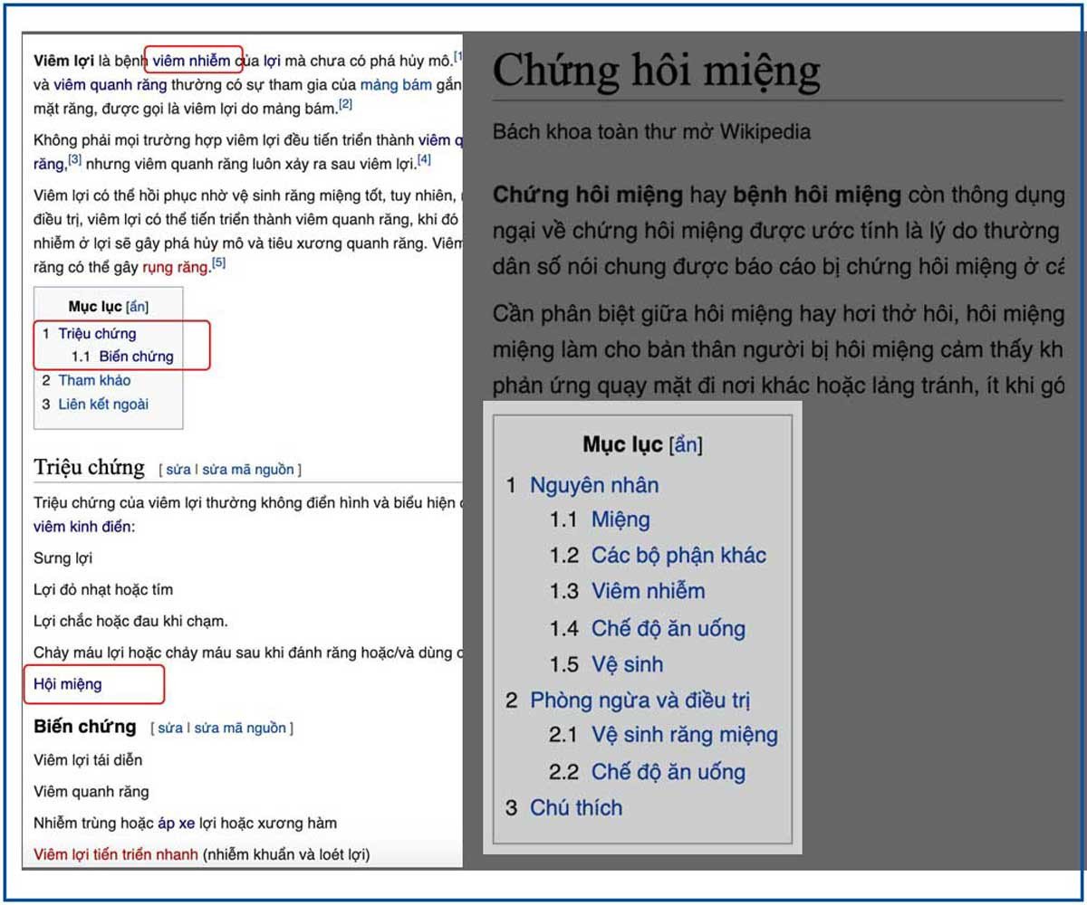 Các gợi ý từ khóa ngữ nghĩa và liên quan được thu thập từ mục lục Wikipedia cho chủ đề "viêm lợi" để mở rộng ý tưởng nội dung.