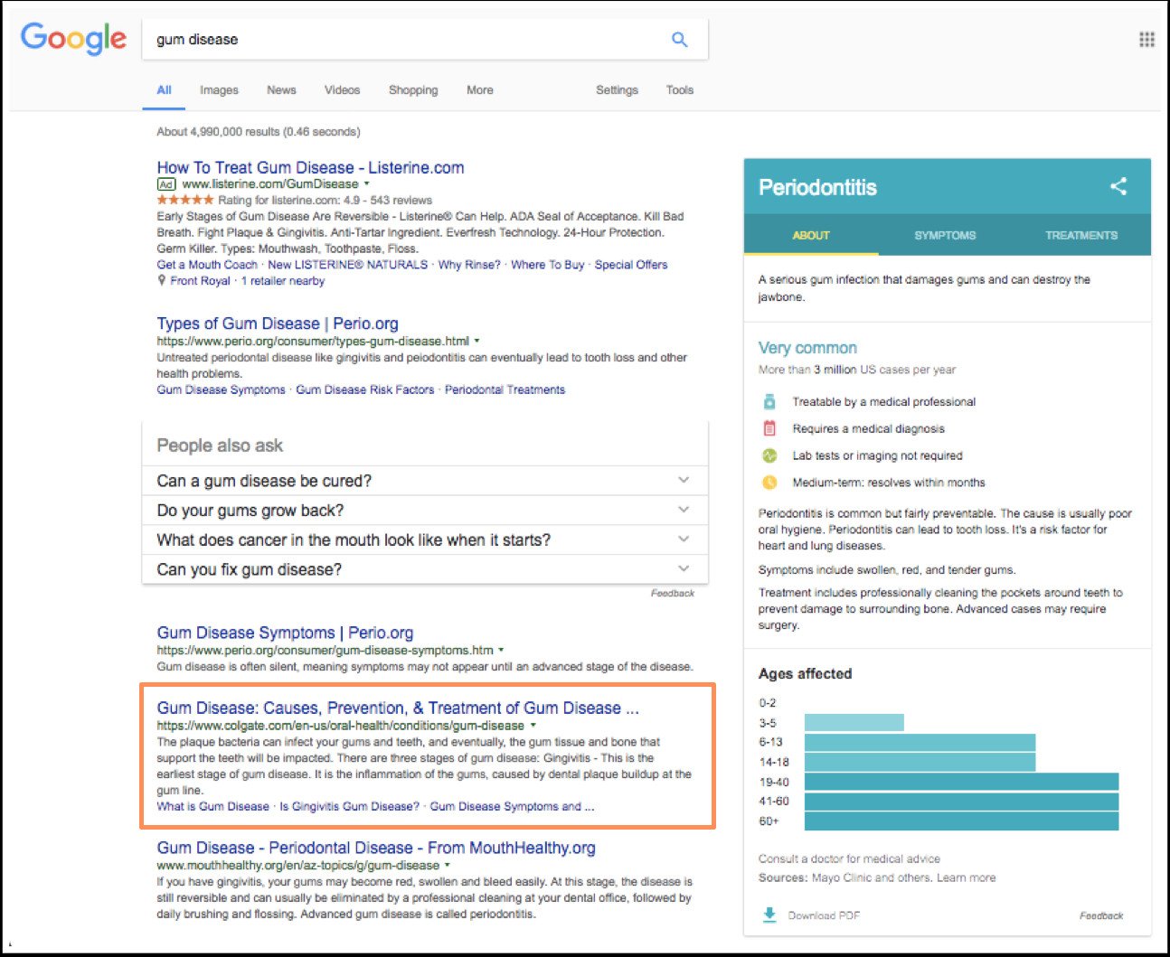 Kết quả tìm kiếm Google cho từ khóa bệnh nướu răng, minh họa tầm quan trọng của tối ưu SEO